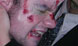 Zombieattacke